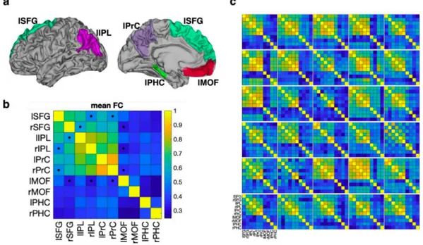Fig.  13. The  brain  regions  used  in  the  evaluation  of  the  default  mode  network
