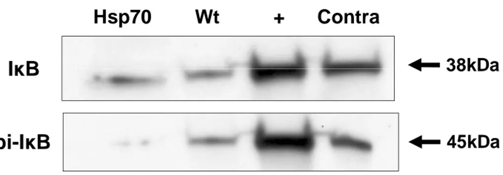 Figure 6. Less I κB phosphorylation observed in Hsp70 transgenic mice. Western blot  of I κB show no difference in the amount of total IκB protein in the brain of Hsp70 Tg  and  Wt  mice  exposed  to  tMCAO