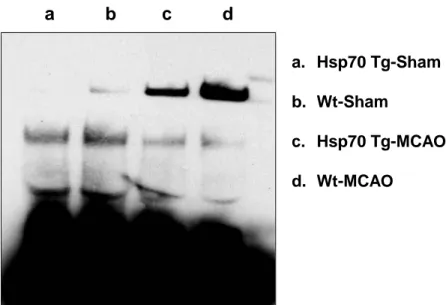 Figure  8.  Decreased  DNA  binding  of  NF- κB  in  Hsp70  Tg  mice.  Using  an  EMSA  assay that estimates DNA binding capacity of NF-kB activity was observed in Hsp70  Tg  and  Wt  mice  brains