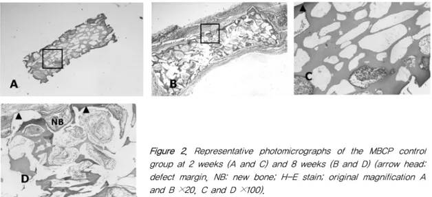Figure  2.  Representative  photomicrographs  of  the  MBCP  control  group at 2 weeks (A and C) and 8 weeks (B and D) (arrow head:  defect margin, NB: new bone; H-E stain; original magnification A  and B ×20, C and D ×100).
