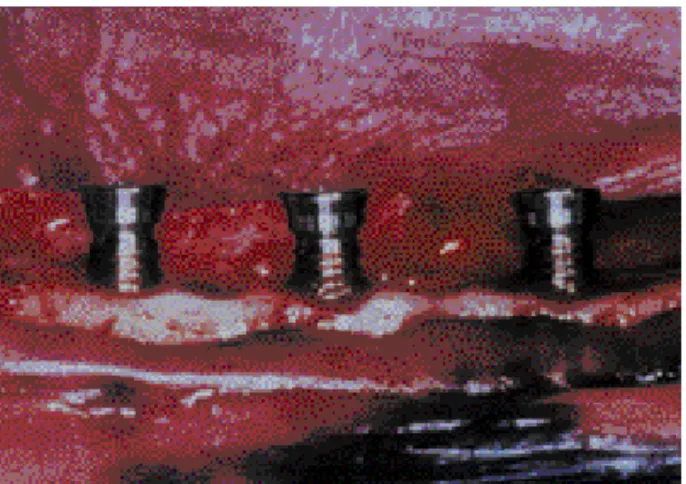 Figure 1 Figure 2