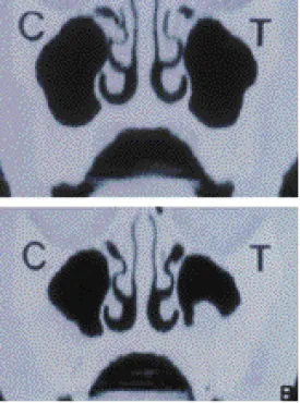 Figure 10 Figure 11