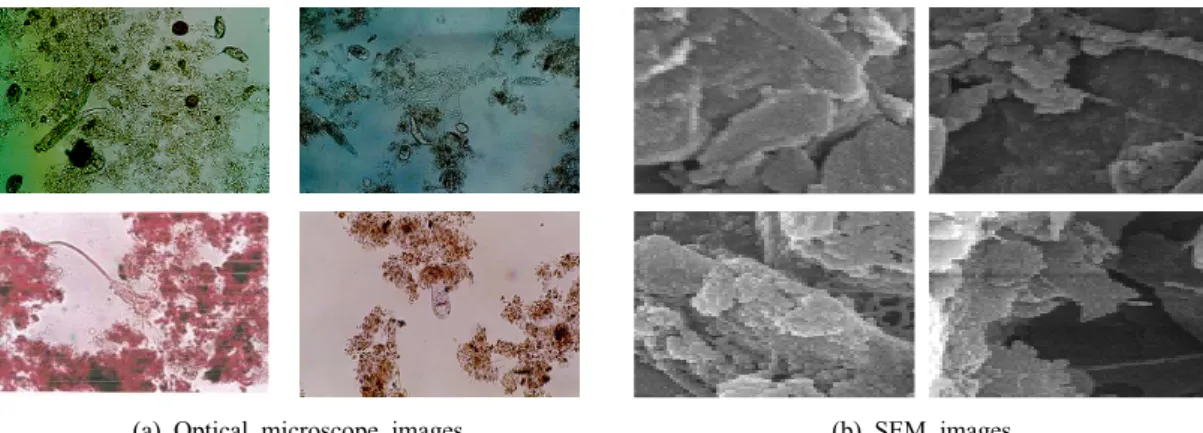 Fig. 8. Optical and scanning electron microscopic photograms of microorganisms in the water tank.