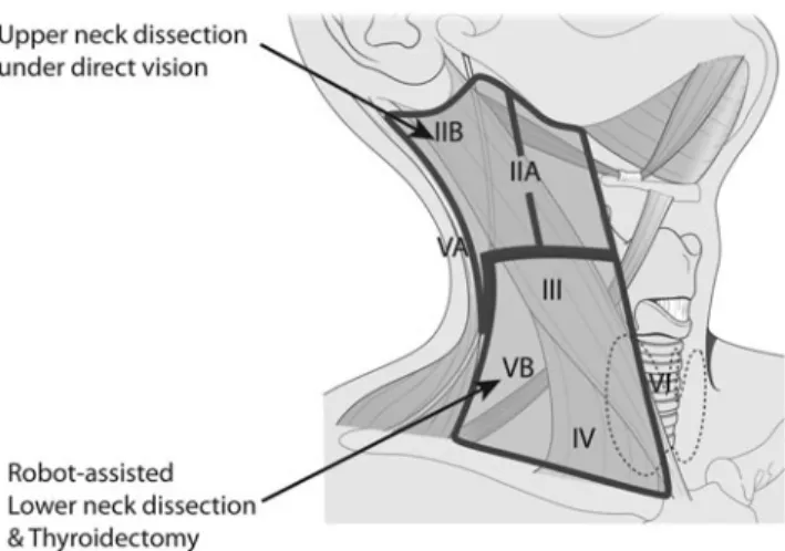 FIG. 1. Schematic drawing of the transaxillary and ret- ret-roauricular approaches. Upper neck dissection (Levels IIA, IIB, and VA, as well as the upper III level) can be performed under direct visualization through the retroauricular incision (upper outli
