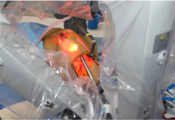Figure 1.  The cadaveric study of robot-assisted nipple-sparing mastectomy with immediate breast  reconstruction.