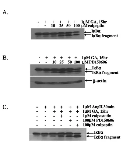 Fig. 8. Effects of calpain inhibitors on the I κBα cleavage. Cells were treated with 