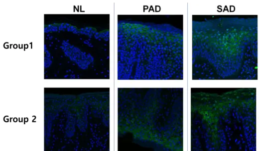 Figure  7.  Immunofluorescence  staining  of  FABP5  in  NL,  PAD  and  SAD  human skin