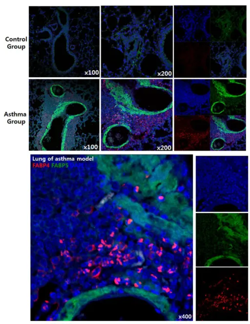 Figure  9. Increased FABP4 and FABP5  expression in  lungs of OVA-induced  asthma  model