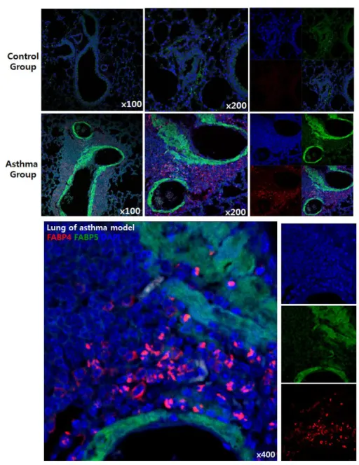 Figure  9. Increased FABP4 and FABP5  expression in  lungs of OVA-induced  asthma  model