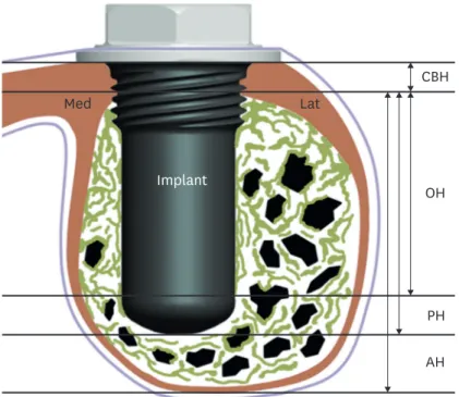 Figure 2.  Schematic showing the measured parameters. 