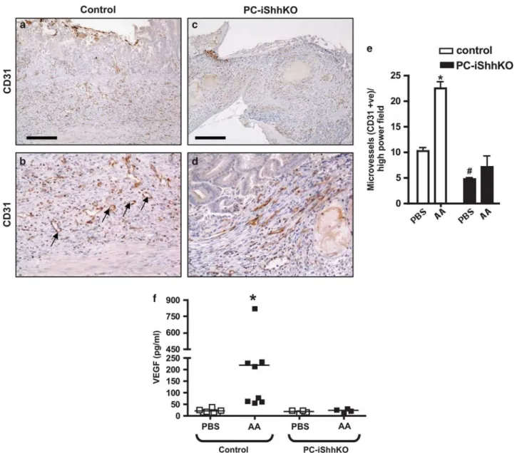 Figure 9 Expression of CD31 and VEGF in control and PC-iShhKO mouse stomachs during wound healing