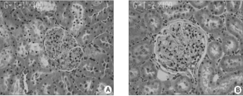 Fig. 2.  Phtomicrograph of rat kidney treated by Cd 1.7 μ g/g/day for 8 weeks (H&amp;E 400X)