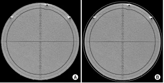 Fig.  1.  Contouring  in  two  trials  (red 