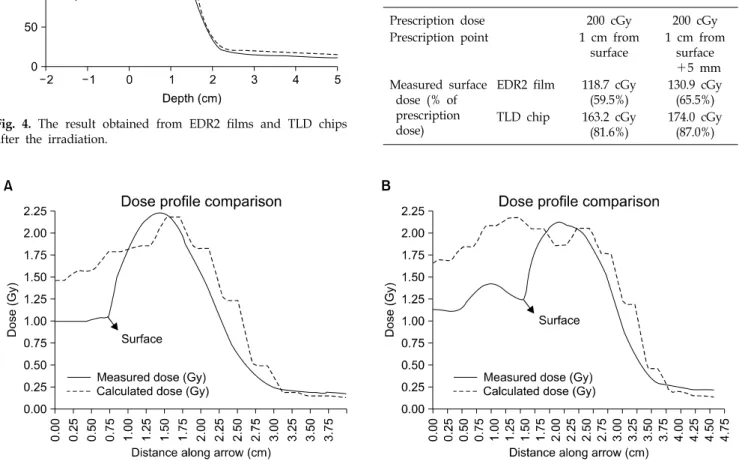 Fig.  5.  Comparison  between  the  calculated  dose  profile  and  the  measured  one