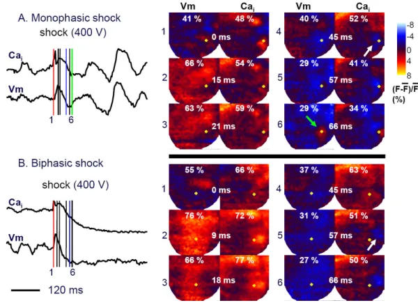 Figure 1. Dual optical mapping of failed defibrillation with MW and successful defibrillation with BW shocks