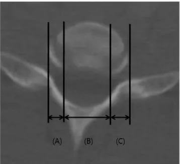 Fig. 1. Distance of longus colli muscle on axial image of MRI: (A) the dis- dis-tance from the lateral margin of the vertebral body to the medial margin  of the right longus colli muscle (right longus colli distance), (B) the  dis-tance from the medial mar