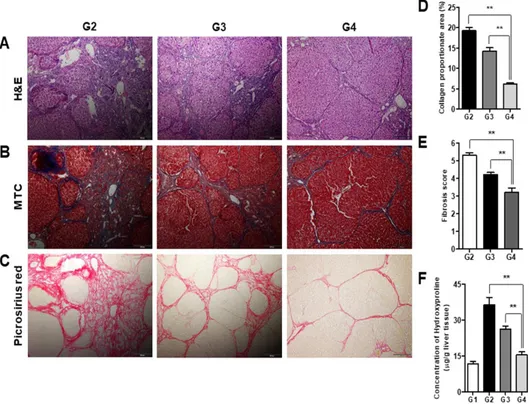 Fig.  3.  Treatment  with  simvastatin  and  BM-MSCs  reverses  histological  changes associated with hepatic fibrosis
