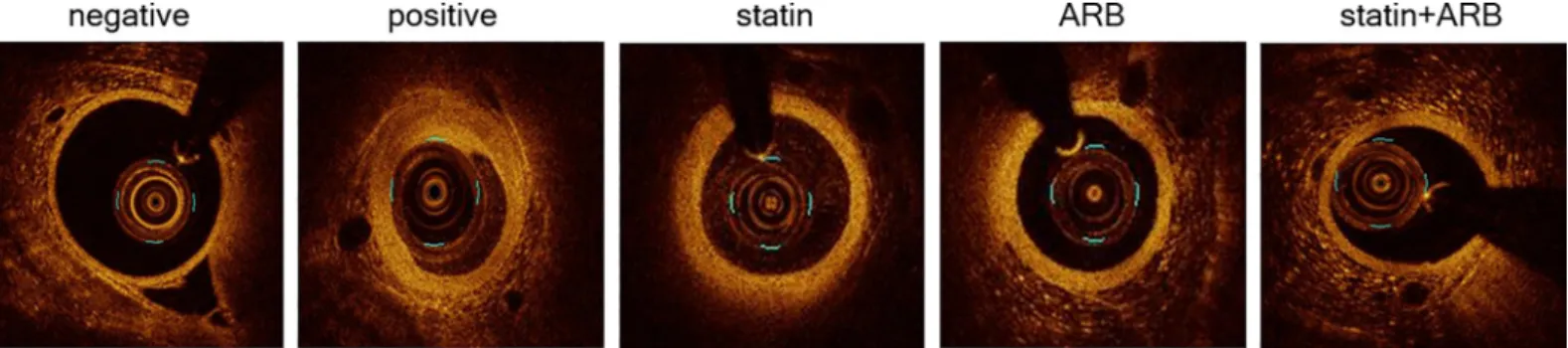Fig 1. Images of optical coherence tomography (OCT). OCT images are shown for each group