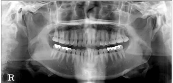 Fig. 1. The panoramic radiography at first visit.