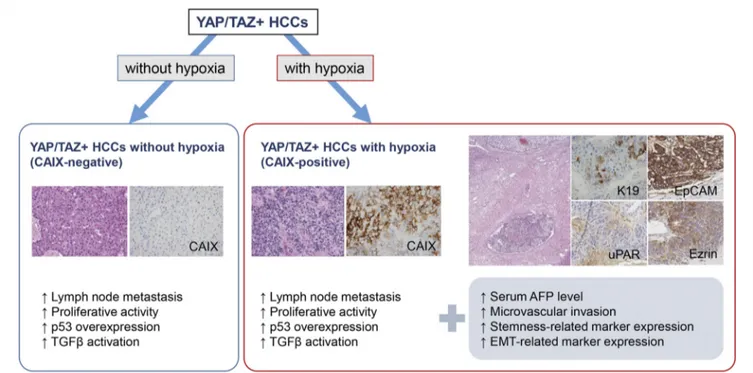 FIGURE 3 | Summary of the characteristics of YAP/TAZ-positive HCCs with relation to hypoxia marker expression status (hematoxylin-eosin stain and CAIX, K19, EpCAM, uPAR and ezrin immunohistochemistry, ×200).