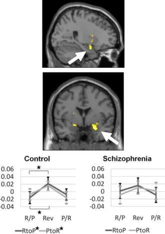 Figure 4. The activation patterns of the amygdala among the region of interest obtained from the 
