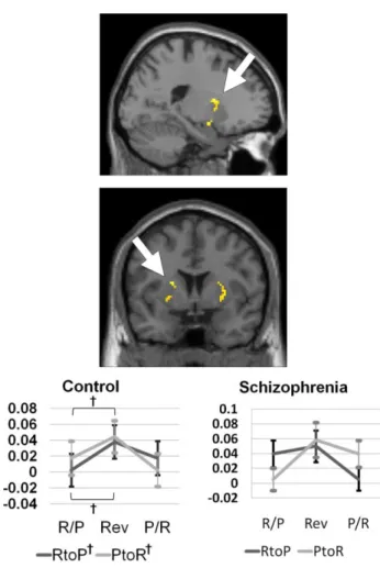 Figure 5. The activation patterns of the putamen among the region of interest obtained from the 