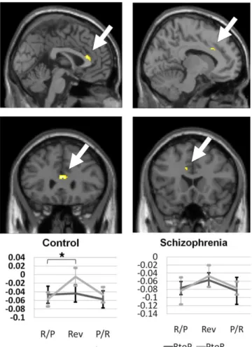 Figure  6.  The  activation  patterns  of  the  anterior  cingulate  cortex  among  the  region  of  interest 
