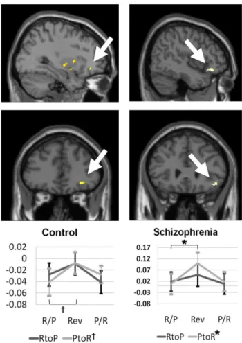 Figure 7. The  activation patterns  of  the  lateral orbitofrontal  cortex  among  the  region  of  interest 