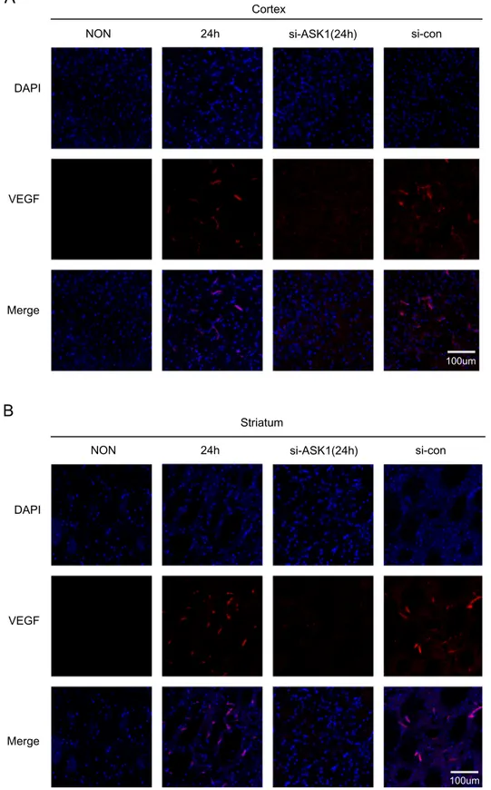 Fig. 6 – Immunochemical image for conﬁrmation of reduced VEGF expression by ASK1-siRNA treatment.