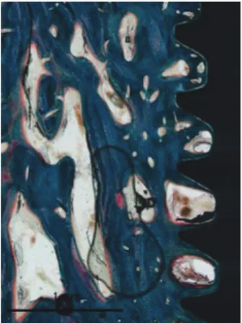 Figure 2.   Histologic view of the sandblasted, large-grit, acid-etched  group at 4 weeks (Goldner’s trichrome staining,  ×40)