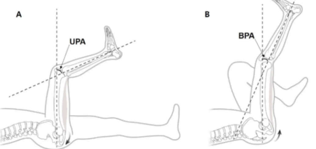 Figure 2.  Popliteal angle was defined as the angle between the femoral extended line and tibia