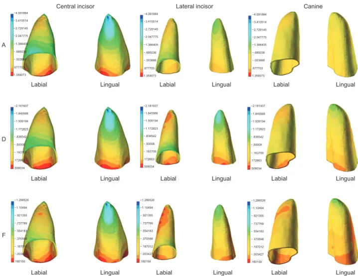 Figure 6. Comparison of the maximum compressive stress distributions in periodontal ligaments with 4 mm of bone loss