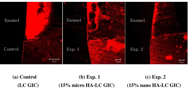 Fig. 8. Interface between tooth and cement observed under CLSM after acid  demineralization (x 10)