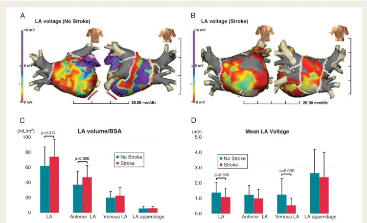 Figure 3 Anterior and posterior views of colour-coded left atrium voltage map during ablation