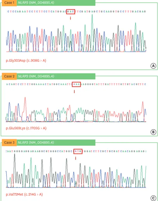 Fig. 2.  Chromatogram of the NLPR3 gene mutations in the patients in cases 1 (A), 2 (B), and 3 (C).
