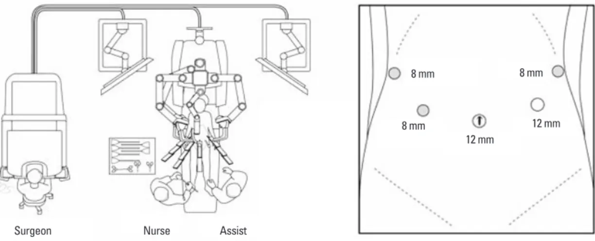 Fig. 2. The schema for port placement and operation room.