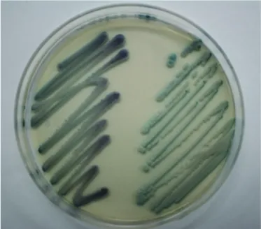 Fig. 2.  Candida dubliniensis on CHROMagar Candida plate incu- incu-bated at 35°C for 48 hr (left, C