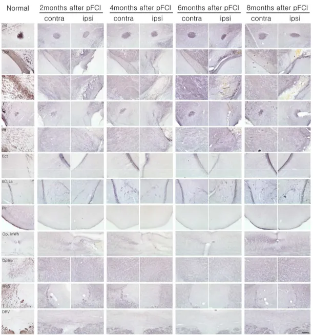 Figure  4.  WGA  immunoreactivity  after  pFCI.  The  WGA  positive-neurons  were  not  detected in lesion sites within 6 months after ischemic injury, whereas reorganized WGA  positive  cells  were  newly  found  in  several  lesioned  sites  except  for 