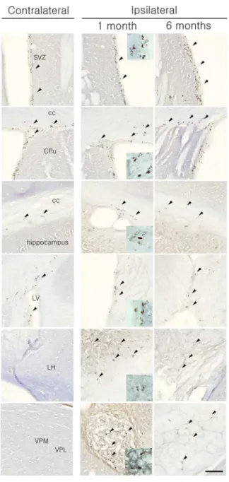 Figure 5. BrdU- immunostaining after pFCI. BrdU positive cells were detected in SVZ and  corpus  callosum  in  both  hemisphere  and  increased  in  SVZ,  thalamic  and  hypothalamic  areas  in  ipsilateral  side  at  1  month  and  6months