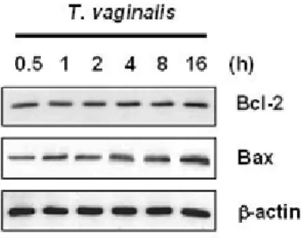 Figure II-2. T. vaginalis did not affect Bcl-2 expression in RAW264.7 cells. RAW 264.7 cells  were treated with T