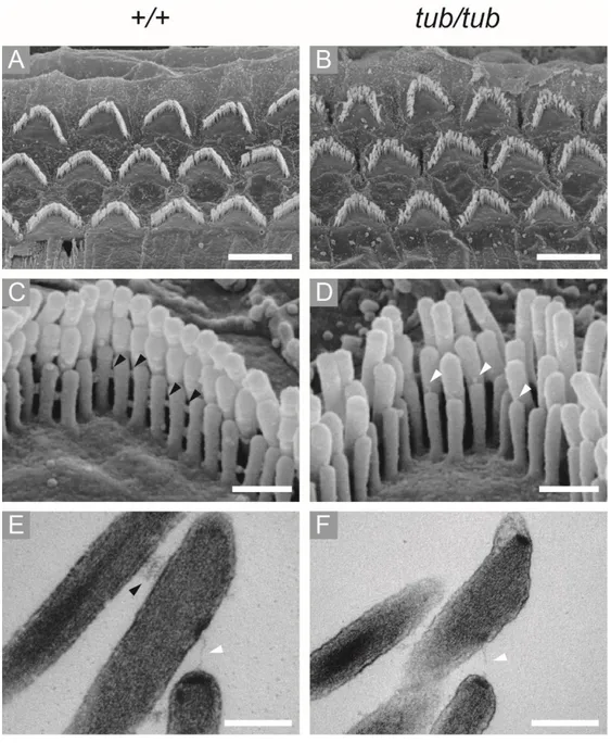 Figure 2. OHCs hair bundle morphology of wild-type and tubby mice. SEM and 