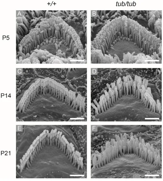 Figure  3. OHCs  hair  bundle  morphology  of wild-type  and  tubby  mice  during  OHCs  hair  bundle  maturation