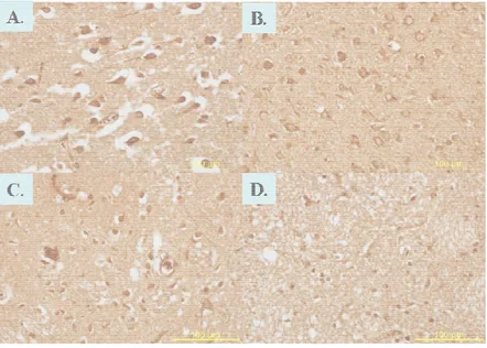Figure  9.  Immunohistochemistry  of  iNOS  in  ischemic  injured  rat  brain. (A.  EC  cortex  B