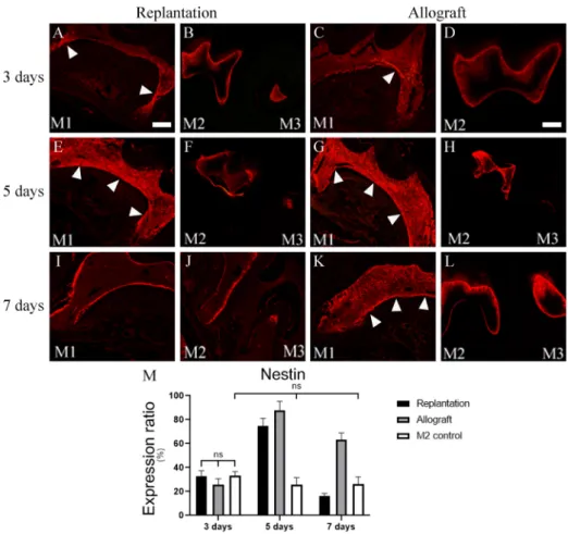 Fig. 3. Comparison of pulpal healing between tooth 