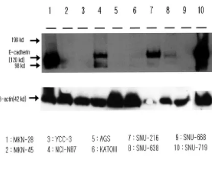 Fig. 1 Western blot analysis of E-cadherin in Human gastric cancer cell  lines. 40 ug nuclear extracts from the cell lines were used in the assay