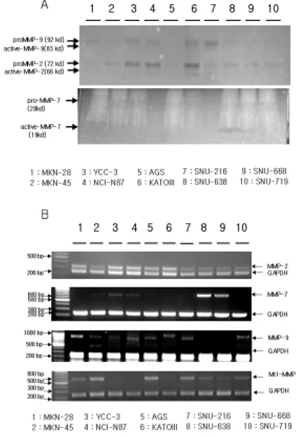 Fig 3. (A) Zymograph of conditioned media samples from human gastric 