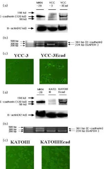 Fig 4. Restoration of E-cadherin expression in Human gastric cancer cell  line YCC-3 and KATOIII cell lines