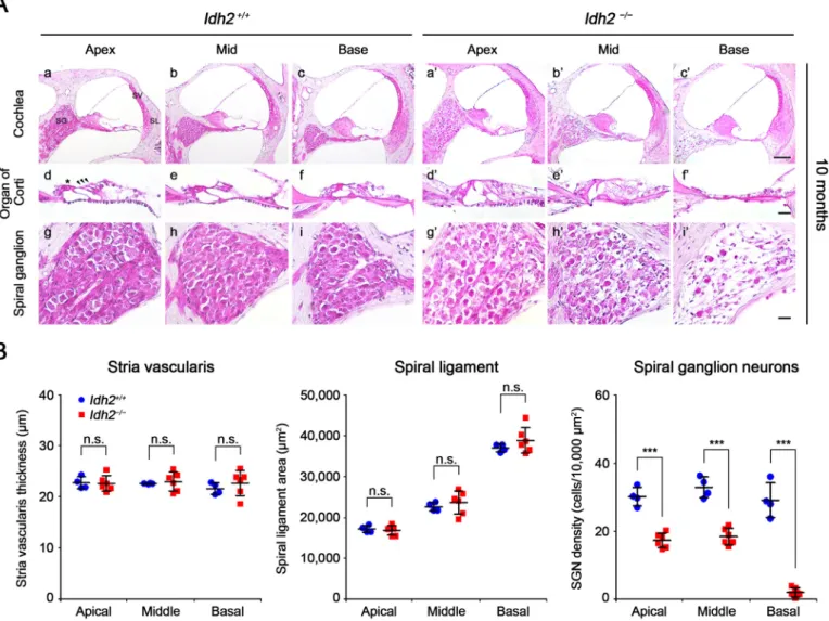 Fig. 2. Histological evaluation of cochlea from Idh2 +/+ and Idh2 −/− mice. (A) H&amp;E staining was performed in the inner ear sections of Idh2 +/+ (n = 4) and