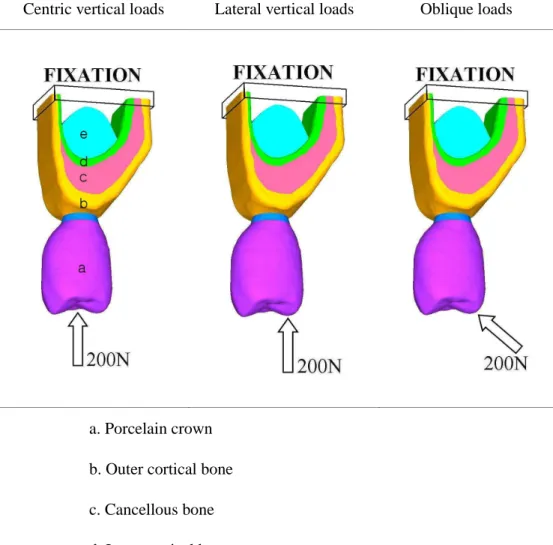 Figure 4. Values and distribution of loads applied to finite element model. 