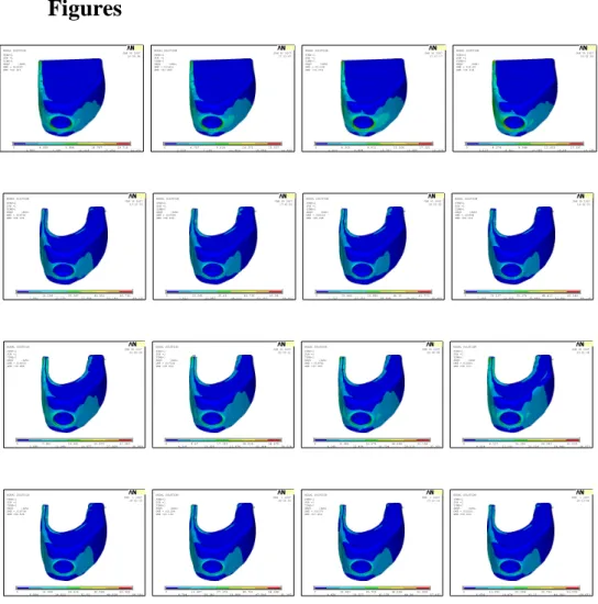 Figure  5.  Distribution  of  stresses  in  all  locations  with  centric  vertical  loads(outer  cortical : 0.5mm)